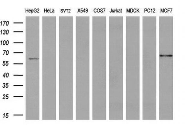 ACSF2 Antibody in Western Blot (WB)