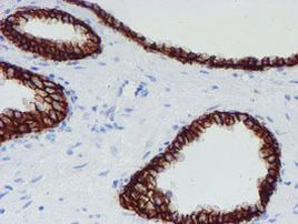 SRPRB Antibody in Immunohistochemistry (Paraffin) (IHC (P))