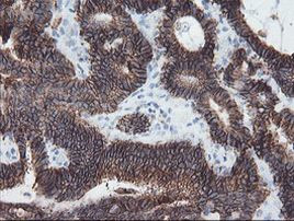 SRPRB Antibody in Immunohistochemistry (Paraffin) (IHC (P))