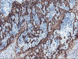 SRPRB Antibody in Immunohistochemistry (Paraffin) (IHC (P))