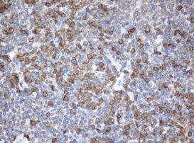 SRPRB Antibody in Immunohistochemistry (Paraffin) (IHC (P))