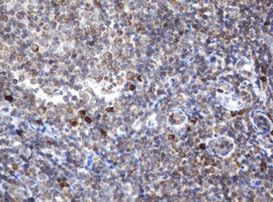 SRPRB Antibody in Immunohistochemistry (Paraffin) (IHC (P))