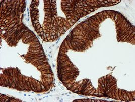 FXYD3 Antibody in Immunohistochemistry (Paraffin) (IHC (P))