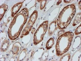 FXYD3 Antibody in Immunohistochemistry (Paraffin) (IHC (P))