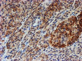 FXYD3 Antibody in Immunohistochemistry (Paraffin) (IHC (P))