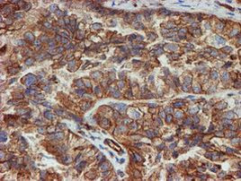 SCFD1 Antibody in Immunohistochemistry (Paraffin) (IHC (P))