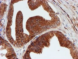 SCFD1 Antibody in Immunohistochemistry (Paraffin) (IHC (P))