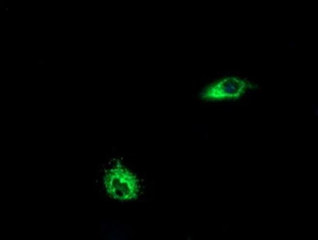 LGR6 Antibody in Immunocytochemistry (ICC/IF)