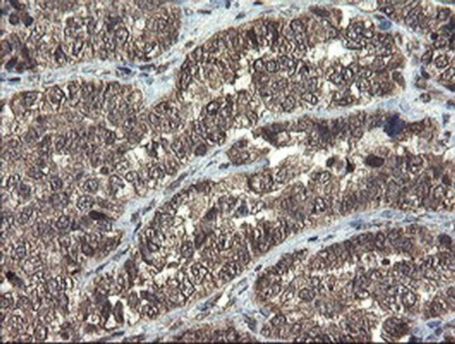 TBCC Antibody in Immunohistochemistry (Paraffin) (IHC (P))