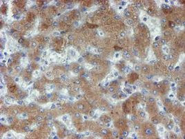 PPAT Antibody in Immunohistochemistry (Paraffin) (IHC (P))