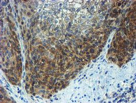 PPAT Antibody in Immunohistochemistry (Paraffin) (IHC (P))