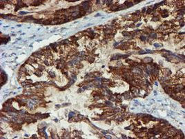 PPAT Antibody in Immunohistochemistry (Paraffin) (IHC (P))