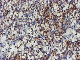 PPAT Antibody in Immunohistochemistry (Paraffin) (IHC (P))