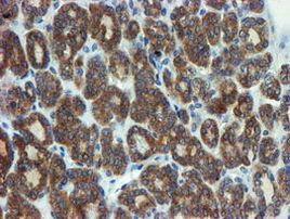 PPAT Antibody in Immunohistochemistry (Paraffin) (IHC (P))