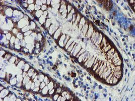 PPAT Antibody in Immunohistochemistry (Paraffin) (IHC (P))