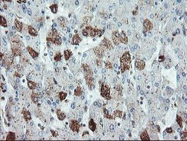 Syntenin 1 Antibody in Immunohistochemistry (Paraffin) (IHC (P))