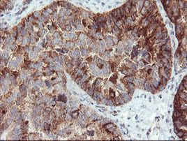 Syntenin 1 Antibody in Immunohistochemistry (Paraffin) (IHC (P))