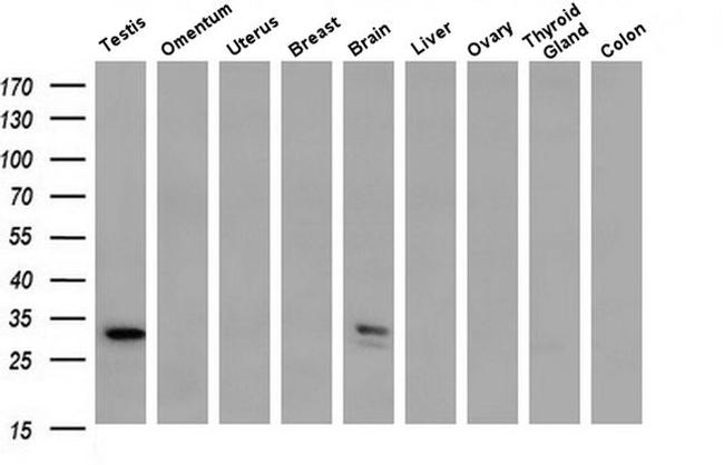 Syntenin 1 Antibody in Western Blot (WB)