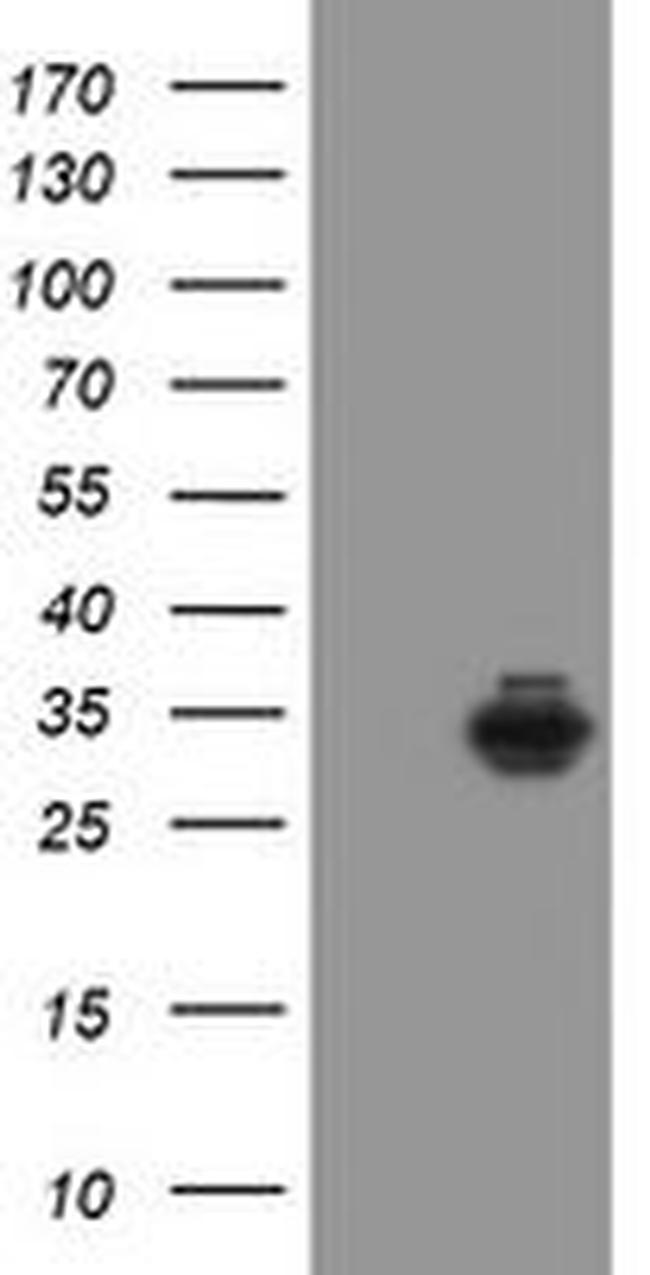 Syntenin 1 Antibody in Western Blot (WB)