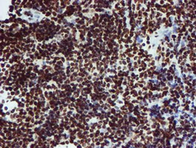 PADI4 Antibody in Immunohistochemistry (Paraffin) (IHC (P))