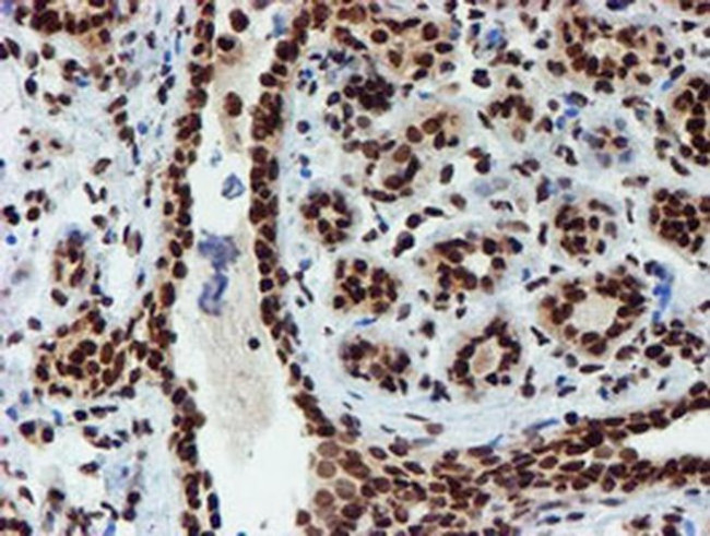 PADI4 Antibody in Immunohistochemistry (Paraffin) (IHC (P))