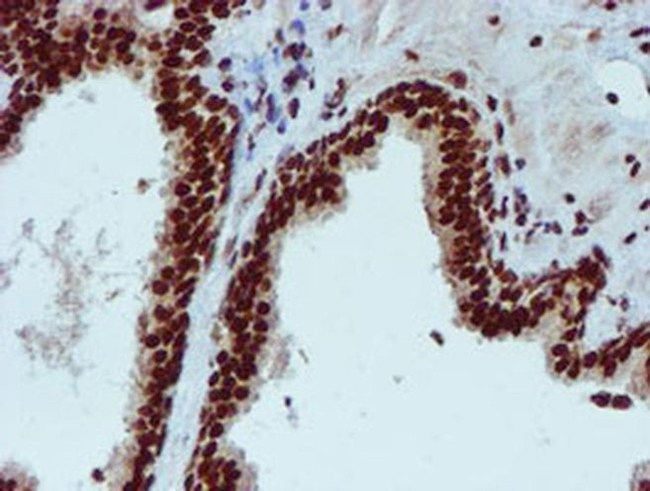 PADI4 Antibody in Immunohistochemistry (Paraffin) (IHC (P))