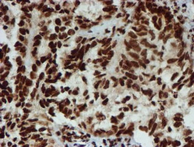 PADI4 Antibody in Immunohistochemistry (Paraffin) (IHC (P))