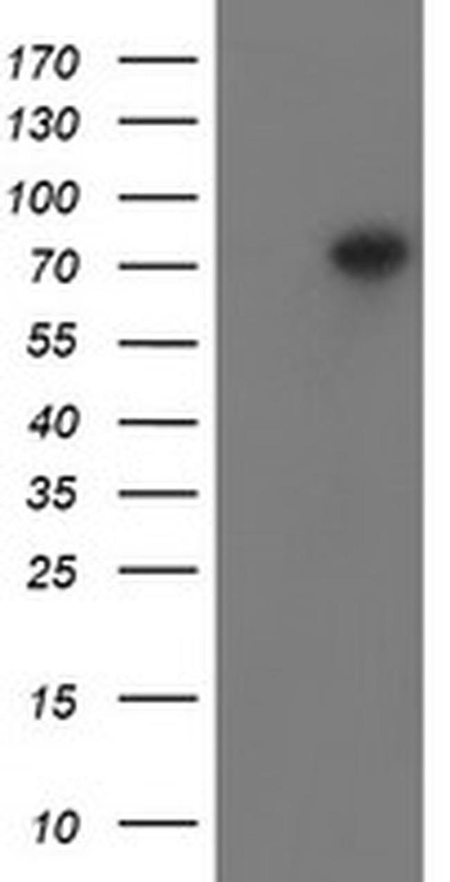 PADI4 Antibody in Western Blot (WB)