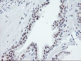 SENP2 Antibody in Immunohistochemistry (Paraffin) (IHC (P))