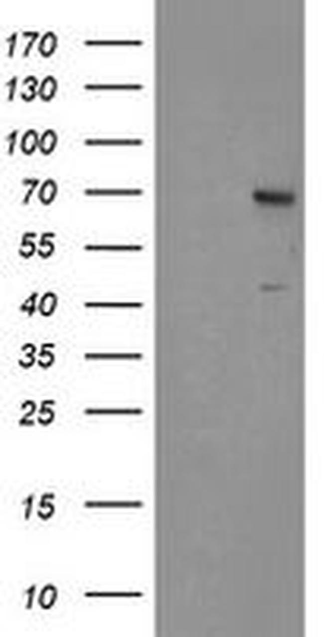 SENP2 Antibody in Western Blot (WB)