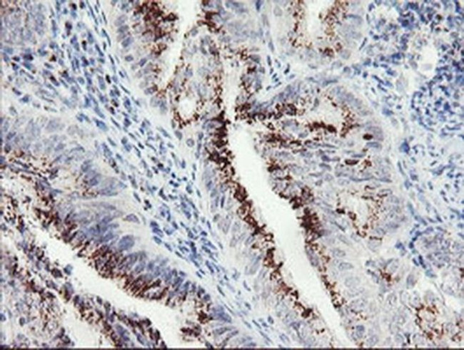 ACBD3 Antibody in Immunohistochemistry (Paraffin) (IHC (P))