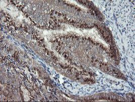 DPH2 Antibody in Immunohistochemistry (Paraffin) (IHC (P))