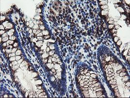 DPH2 Antibody in Immunohistochemistry (Paraffin) (IHC (P))