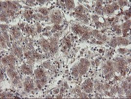 DPH2 Antibody in Immunohistochemistry (Paraffin) (IHC (P))