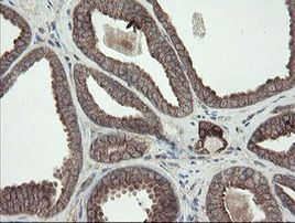 DPH2 Antibody in Immunohistochemistry (Paraffin) (IHC (P))