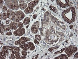 DPH2 Antibody in Immunohistochemistry (Paraffin) (IHC (P))