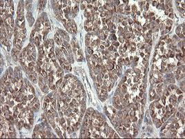 DPH2 Antibody in Immunohistochemistry (Paraffin) (IHC (P))