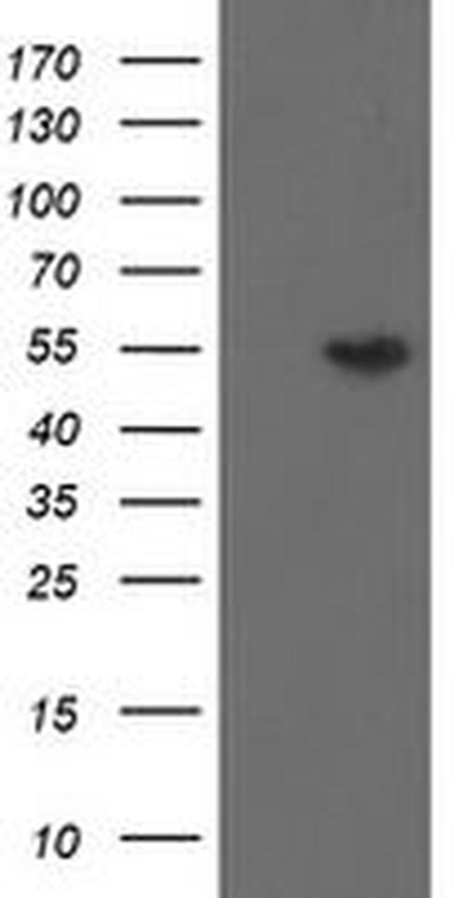 DPH2 Antibody in Western Blot (WB)