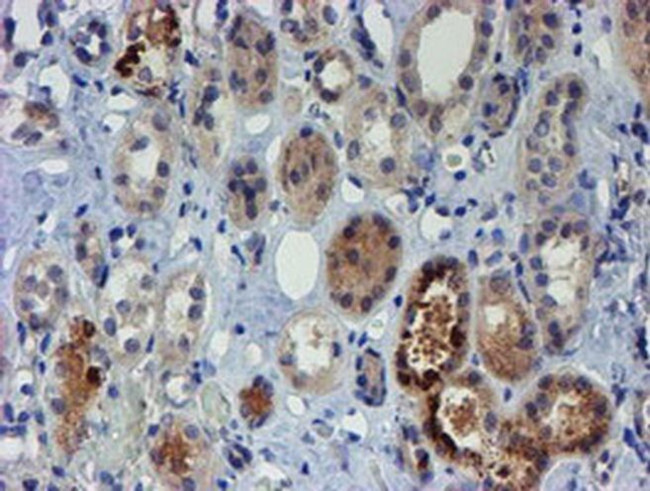 PGM3 Antibody in Immunohistochemistry (Paraffin) (IHC (P))