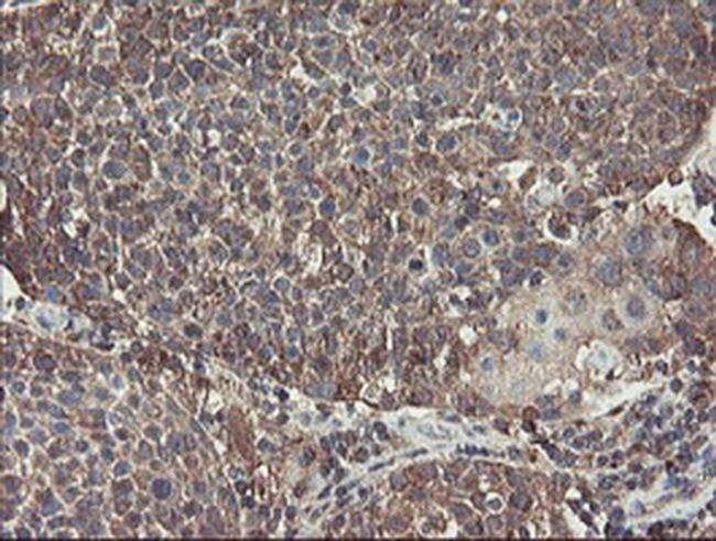 ACBD3 Antibody in Immunohistochemistry (Paraffin) (IHC (P))