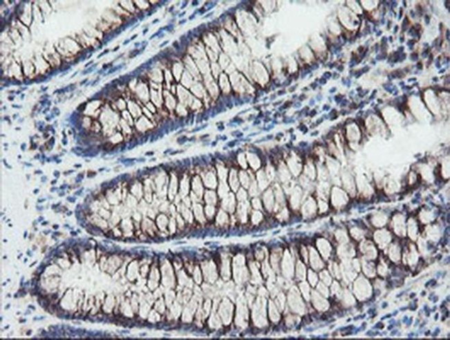 ACBD3 Antibody in Immunohistochemistry (Paraffin) (IHC (P))