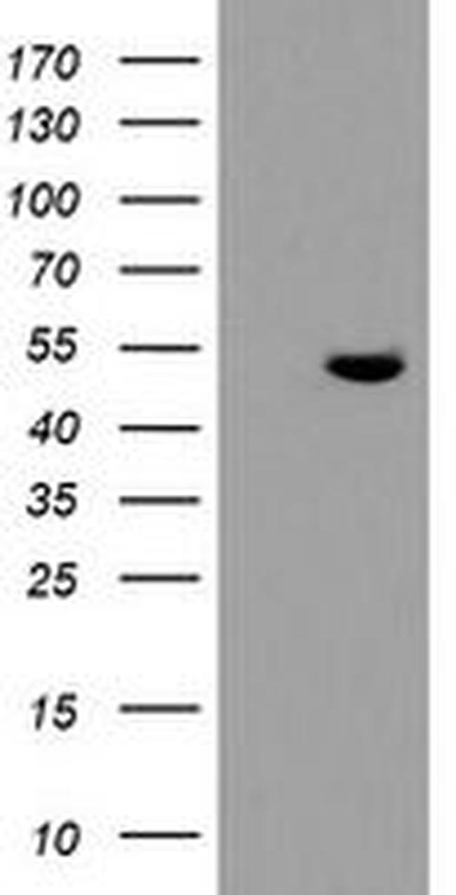 TDO2 Antibody in Western Blot (WB)