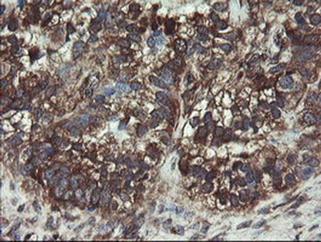 COMMD1 Antibody in Immunohistochemistry (Paraffin) (IHC (P))