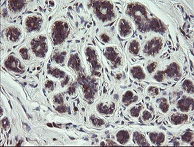 COMMD1 Antibody in Immunohistochemistry (Paraffin) (IHC (P))