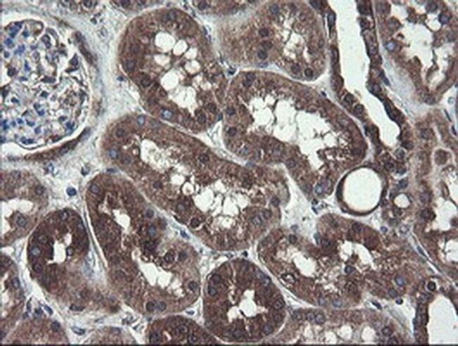 COMMD1 Antibody in Immunohistochemistry (Paraffin) (IHC (P))