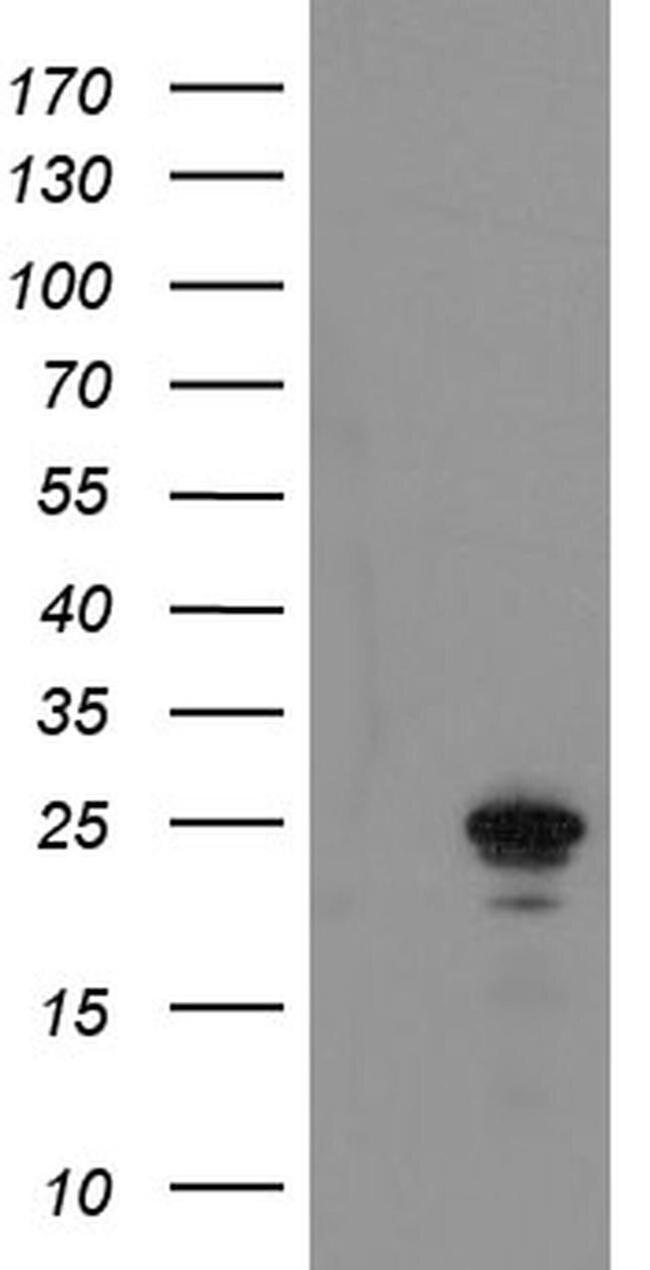 COMMD1 Antibody in Western Blot (WB)