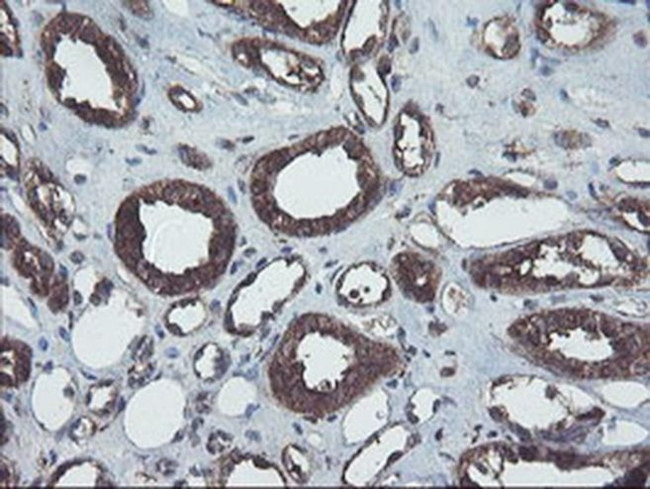 COMMD1 Antibody in Immunohistochemistry (Paraffin) (IHC (P))