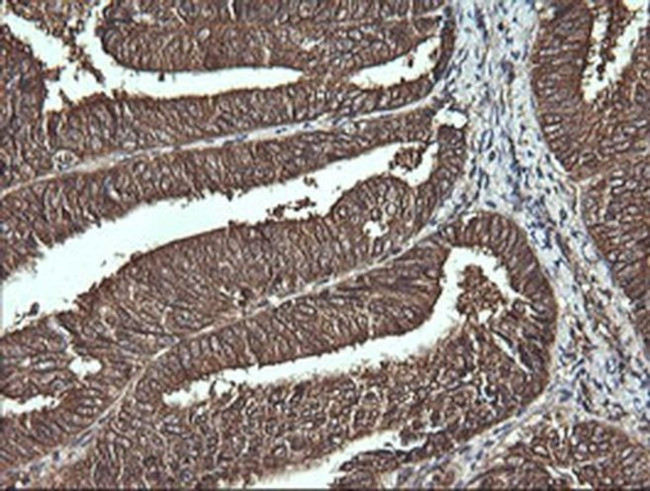 VBP1 Antibody in Immunohistochemistry (Paraffin) (IHC (P))