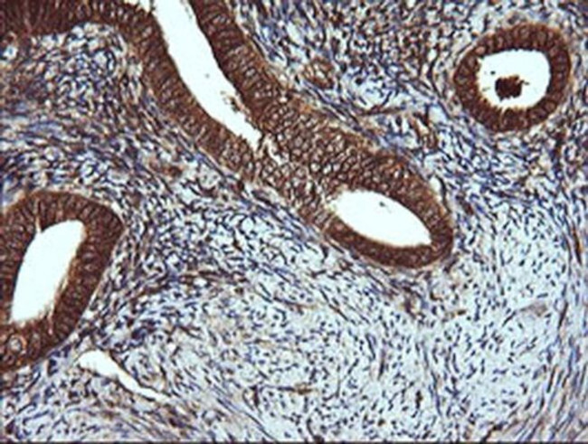 VBP1 Antibody in Immunohistochemistry (Paraffin) (IHC (P))