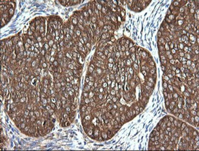 VBP1 Antibody in Immunohistochemistry (Paraffin) (IHC (P))